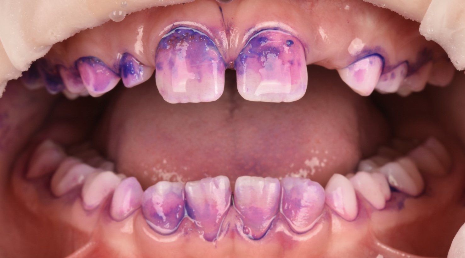 Bezstresowe leczenie