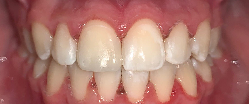 Anti-stress dentistry