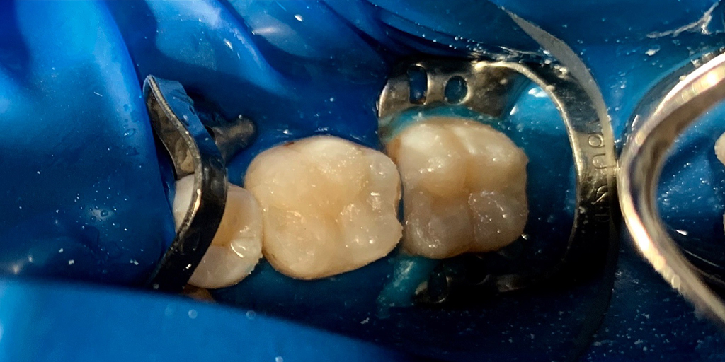 Anti-stress dentistry