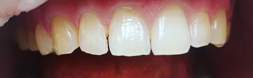 Anti-stress dentistry