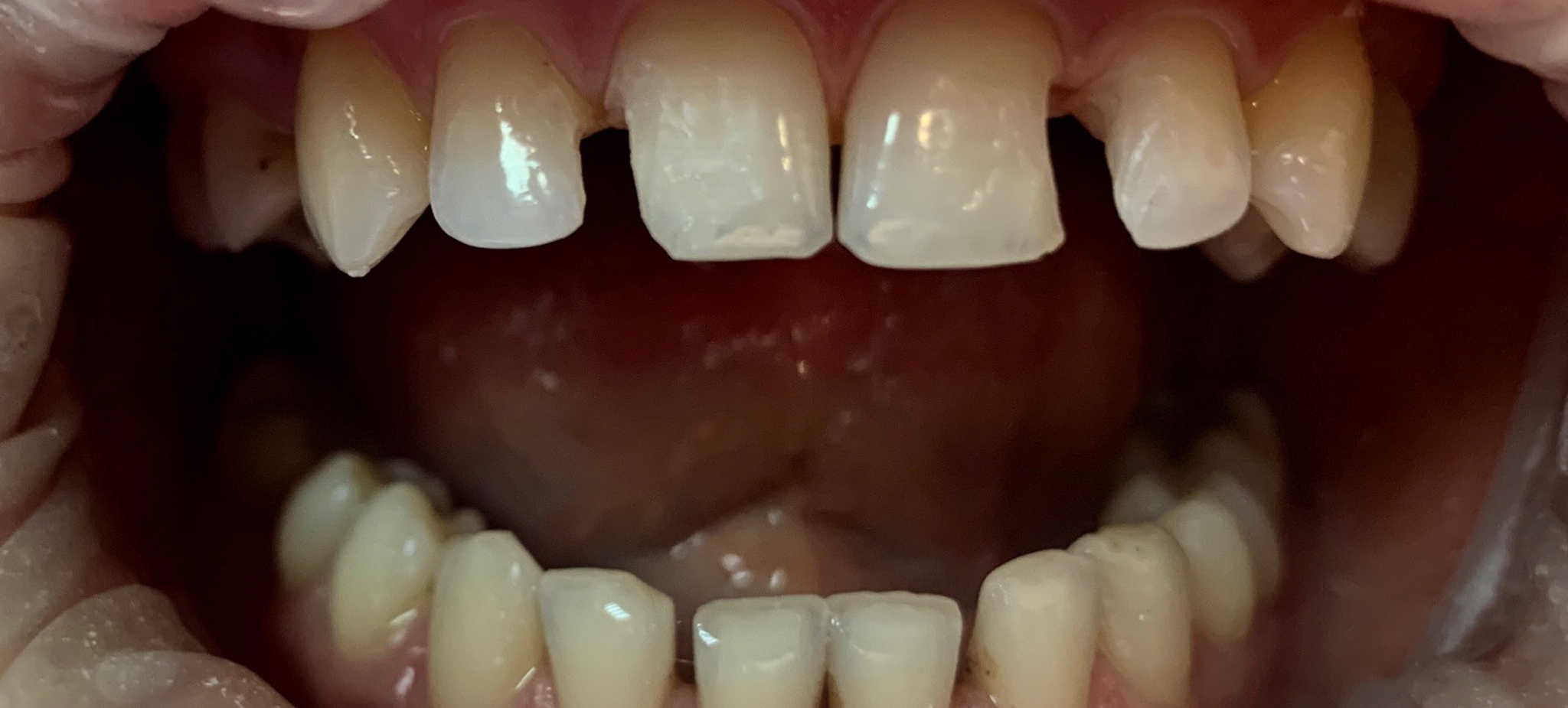 Anti-stress dentistry