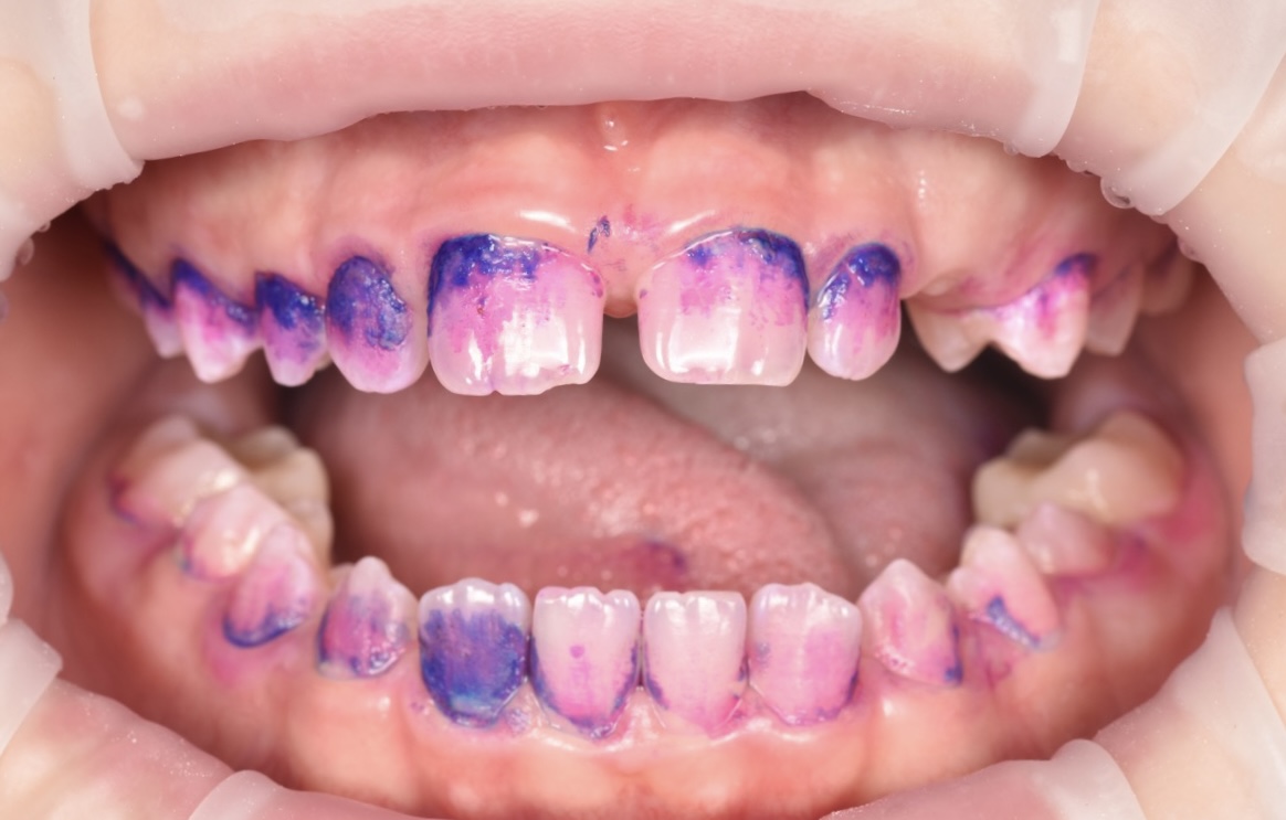 Bezstresowe leczenie