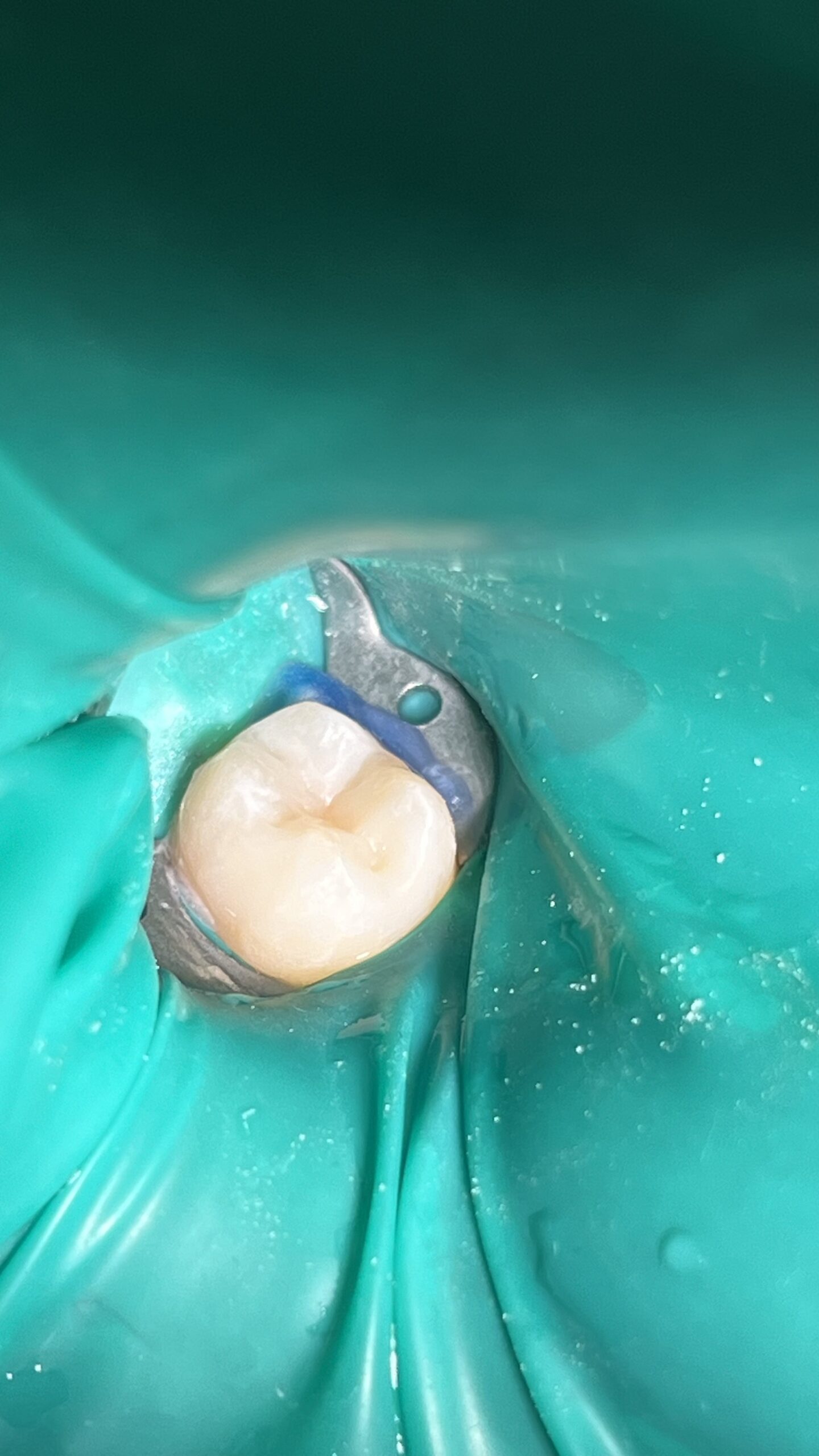 Bezstresowe leczenie