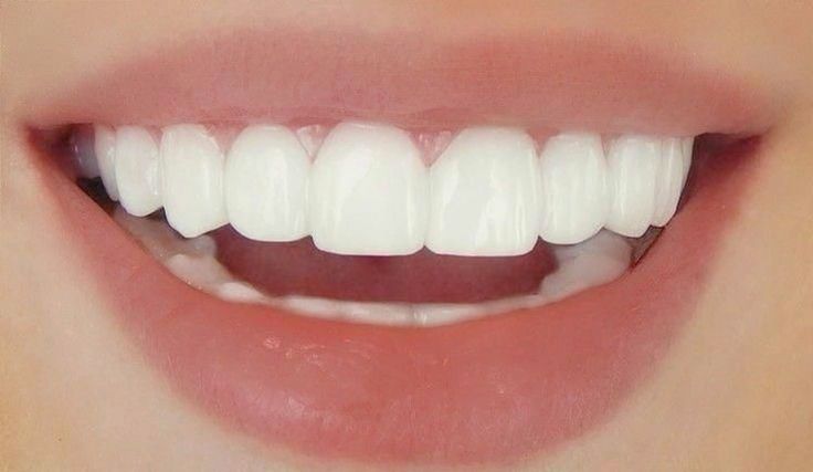 Dental Crowns: Types, Costs, and the Procedure