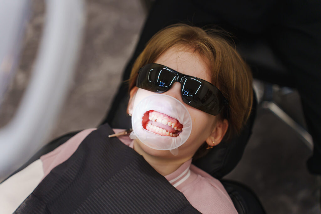 Fissure sealing for children