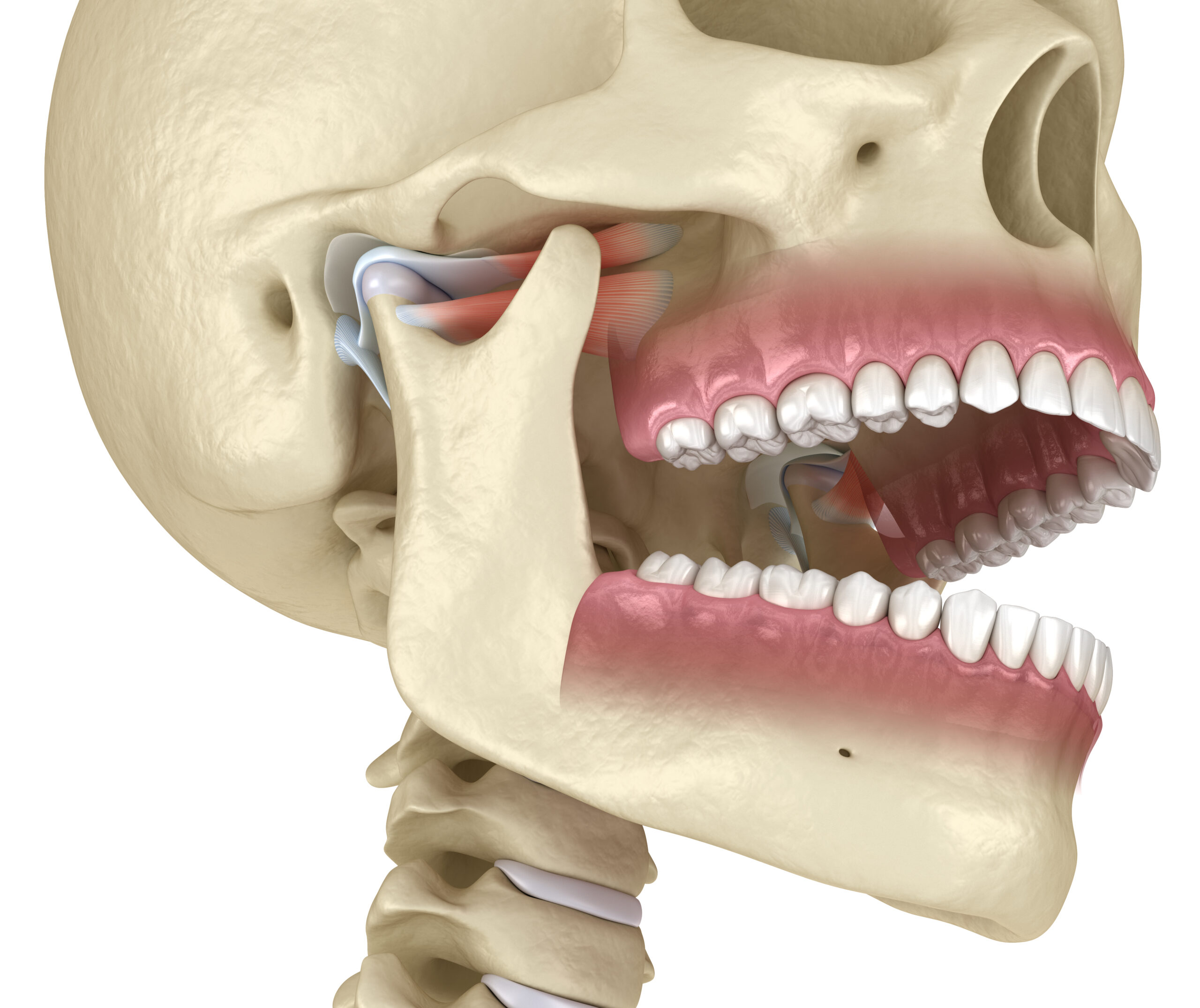 Modern diagnostics and treatment of TMJ dysfunction