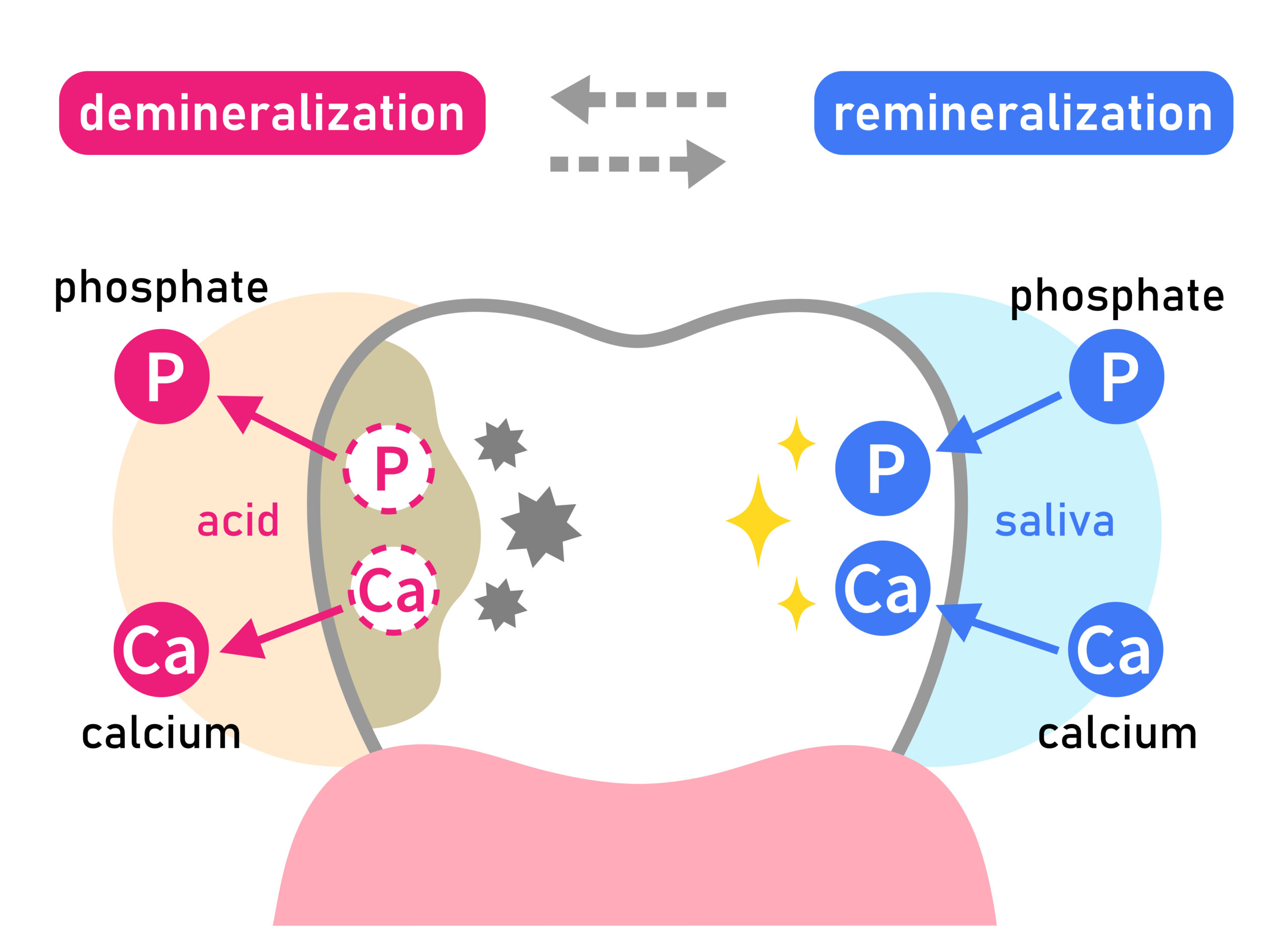 Fluoridation of teeth in children