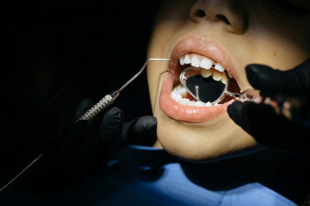 What to Expect After Wisdom Tooth Extraction – Recovery Tips