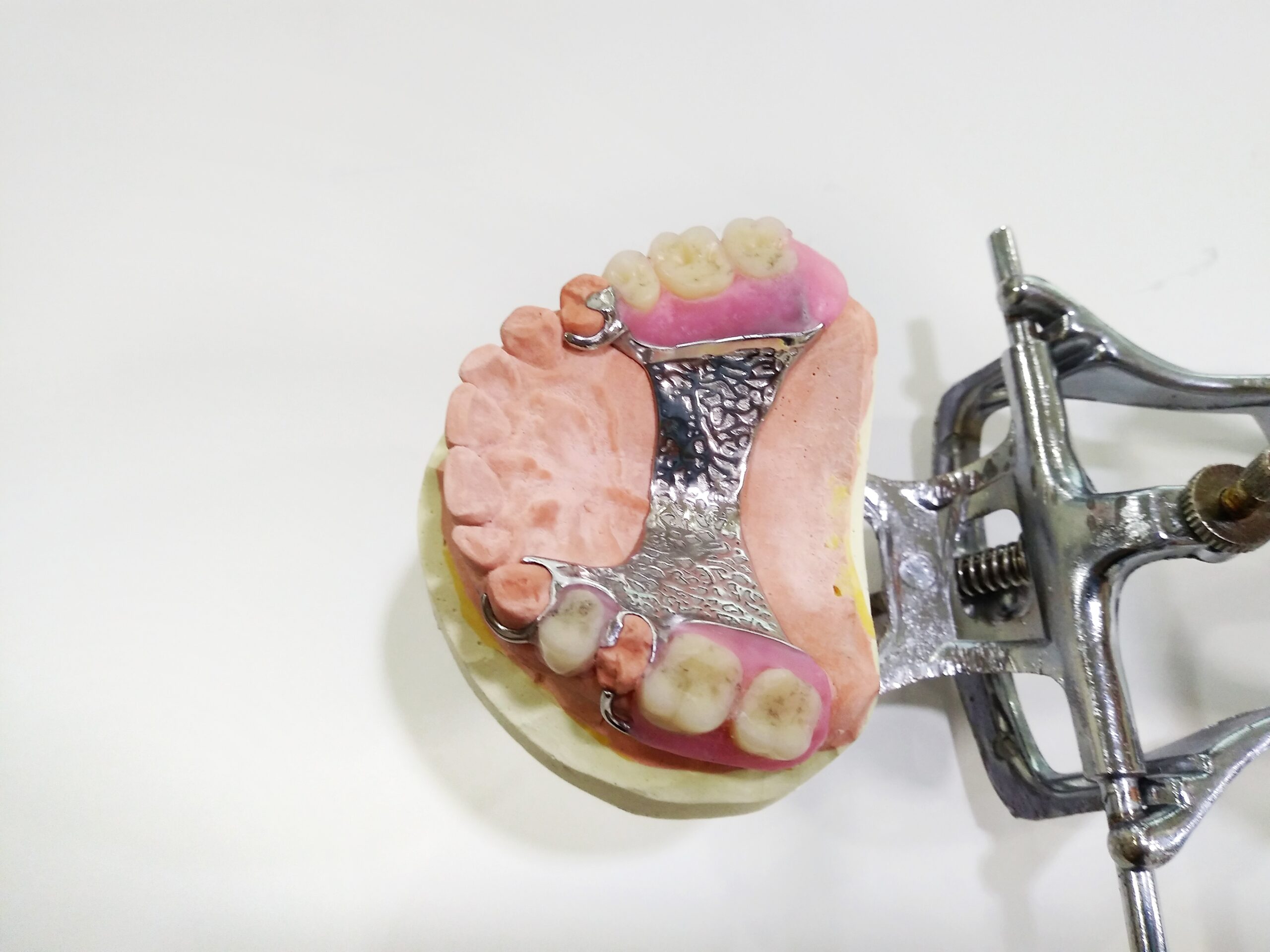 Removable Dentures in Krakow