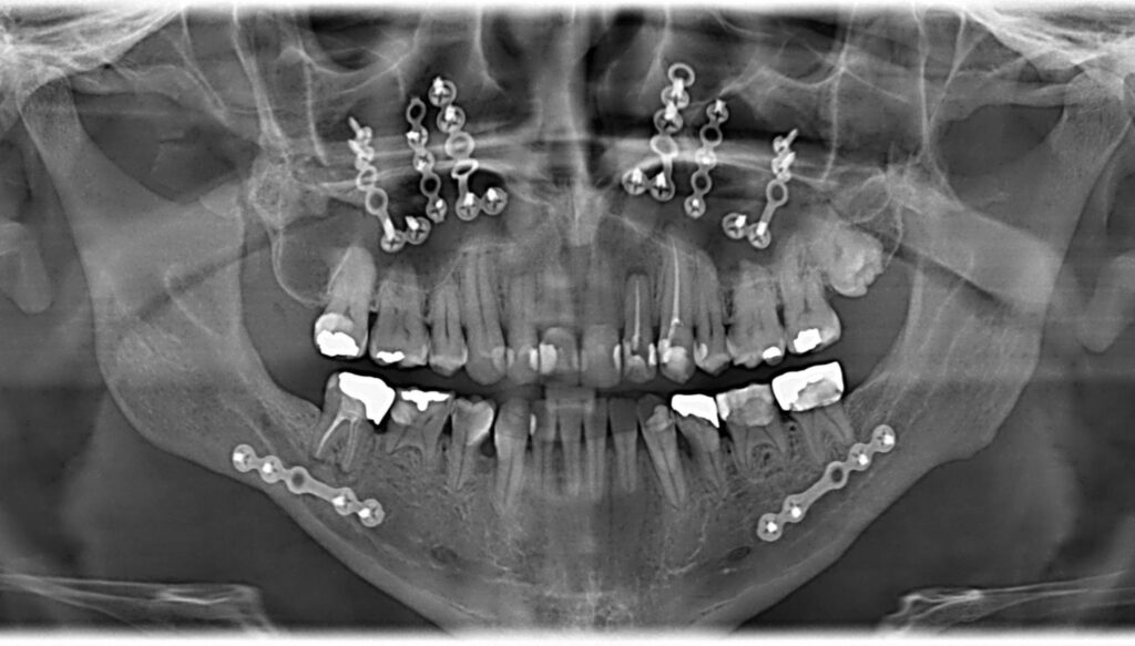 Dental and oral surgery