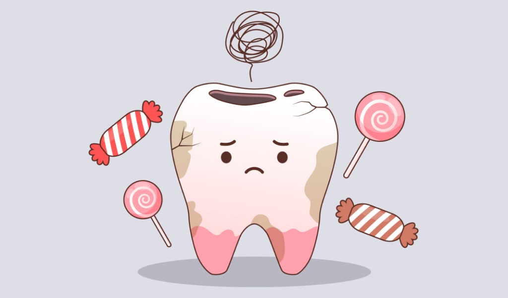 What is tartar removal and how often should you remove it?