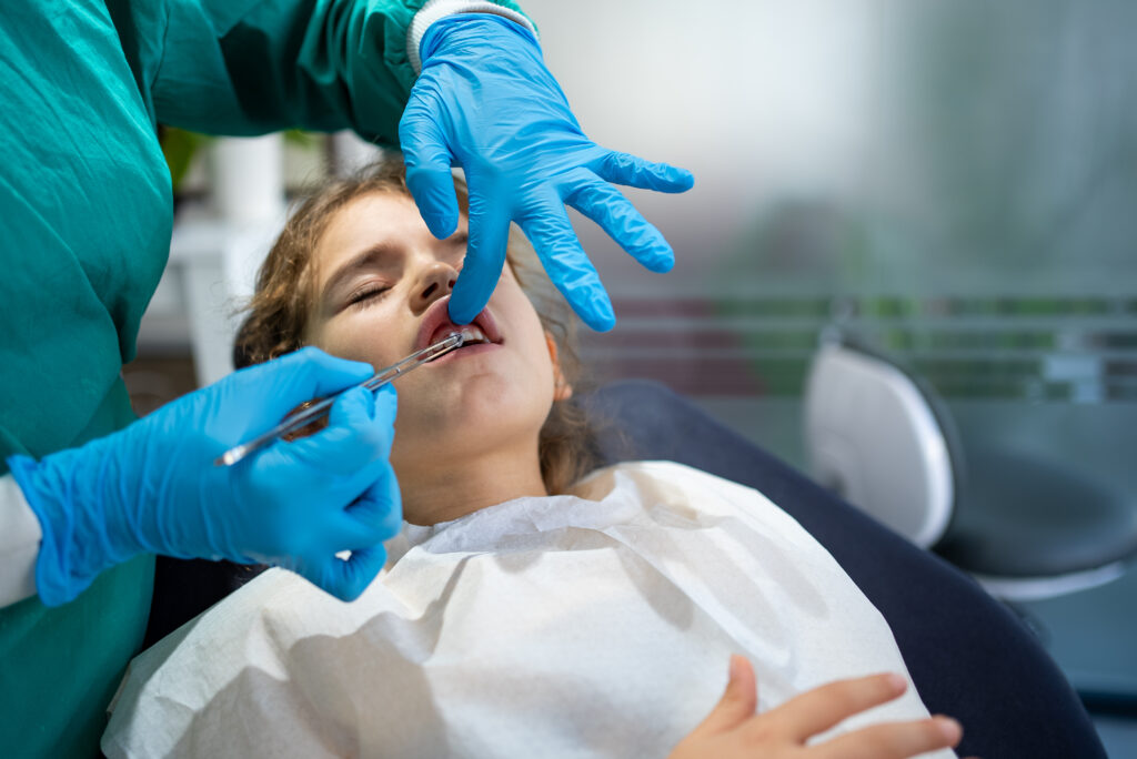 Milk teeth removal