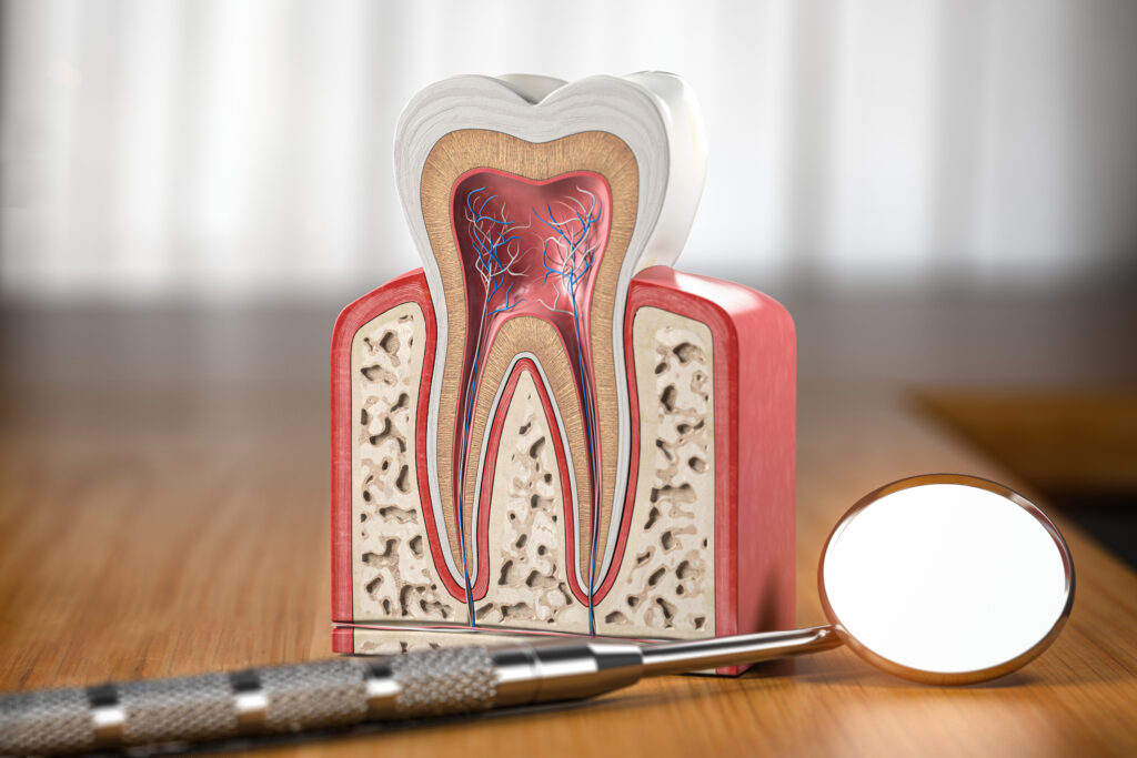 Root Canal Retreatment in Krakow