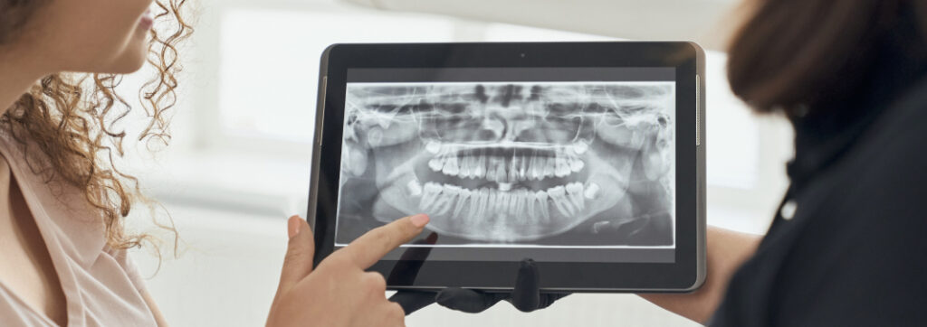 Panoramic X-ray of teeth – effective dental x-ray diagnostics