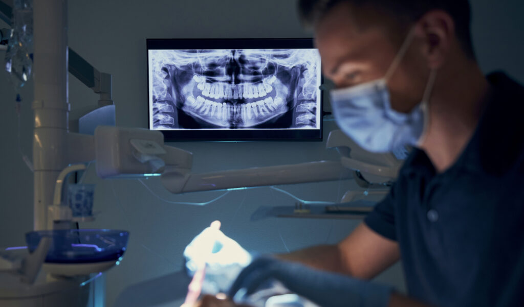 Panoramic X-ray of teeth – effective dental x-ray diagnostics