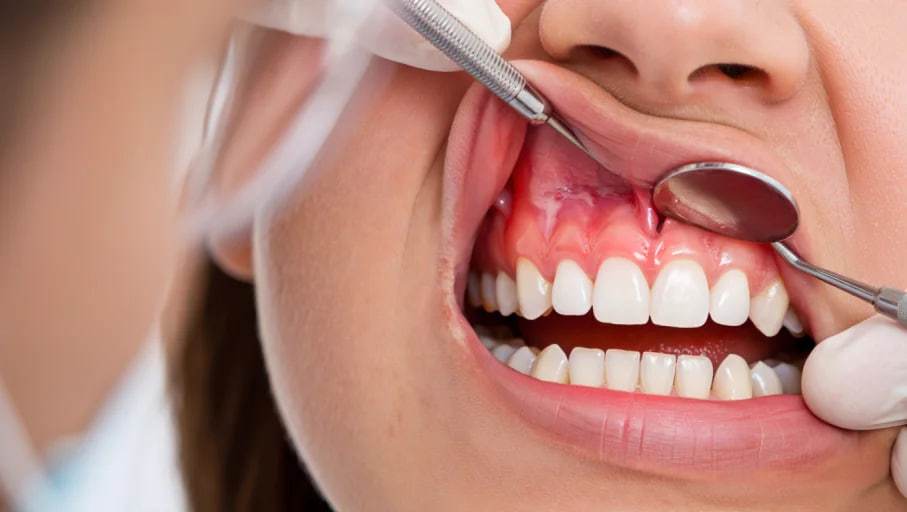 What is Periodontology – What Does a Periodontist Do?