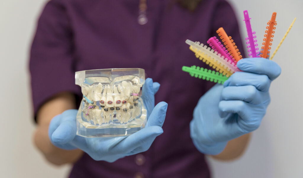 The Role of Orthodontic Elastics in Treatment