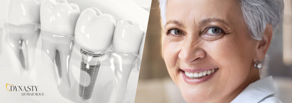 How long does a dental implant last?