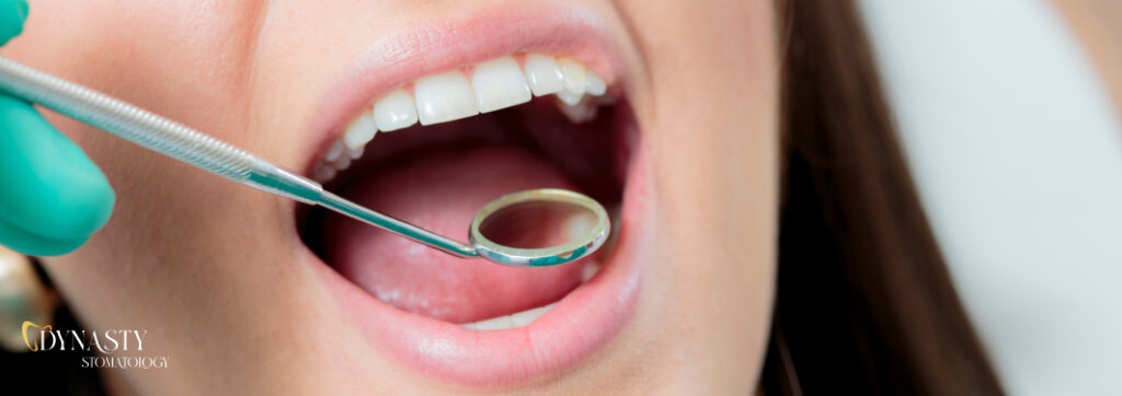 Dry socket – one of the complications after tooth extraction
