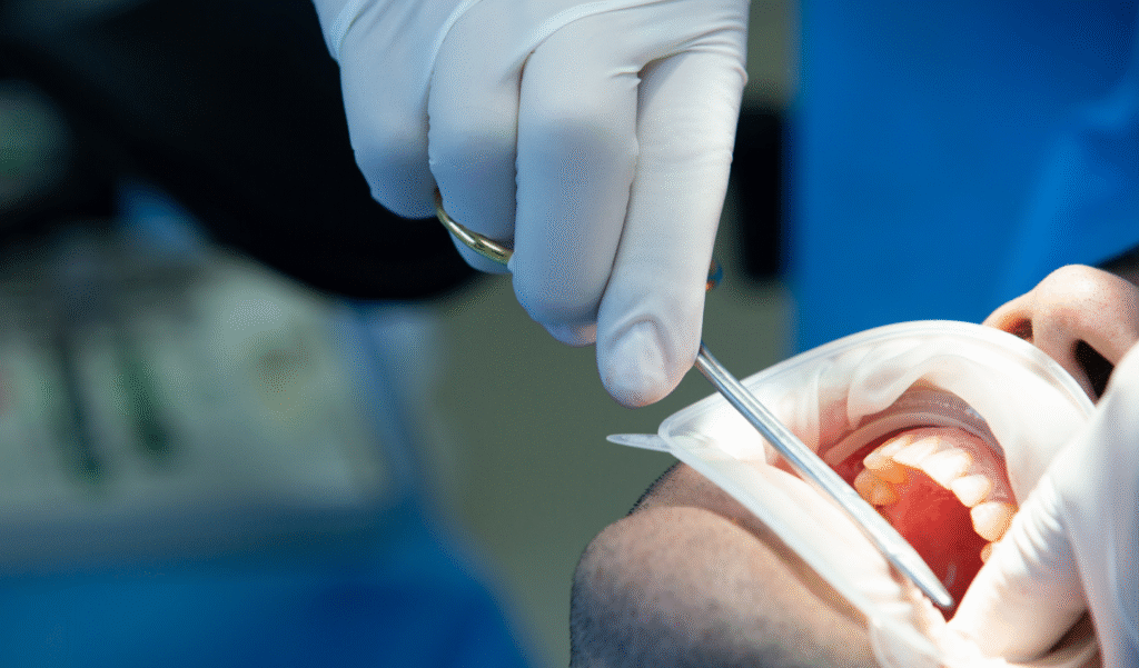 Tooth root resection – when should the apicoectomy be performed?