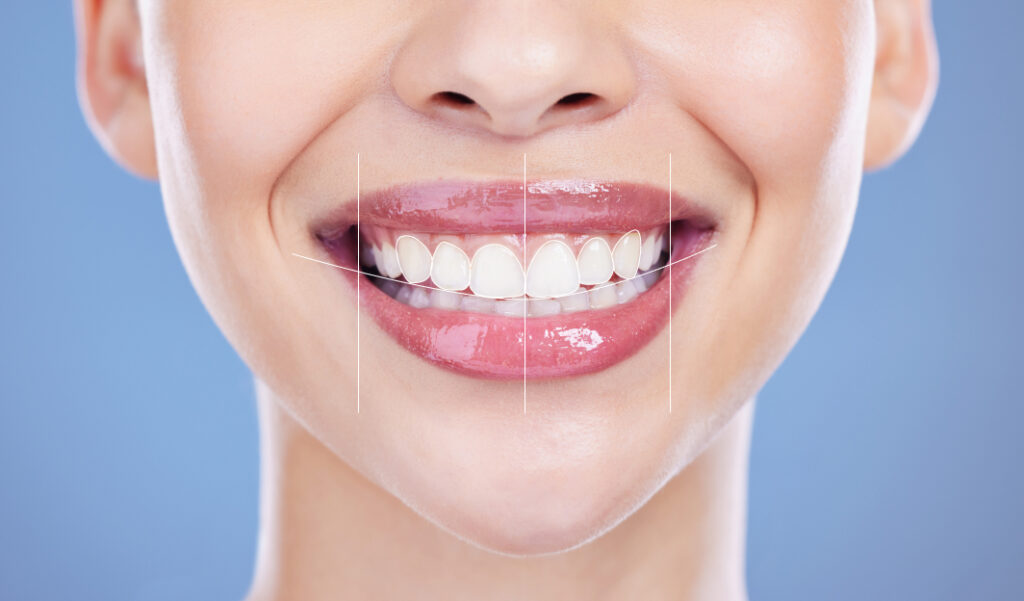 What is Digital Dentistry — Everything you Need to Know