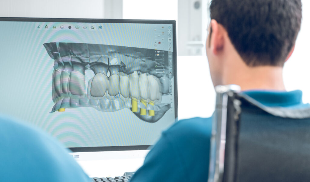 What is Digital Dentistry — Everything you Need to Know