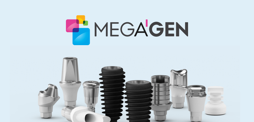 Імплантація