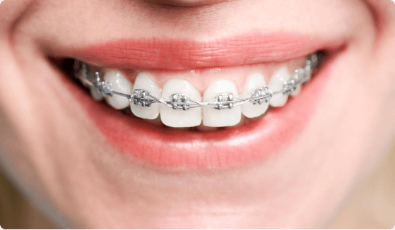 Orthodontics