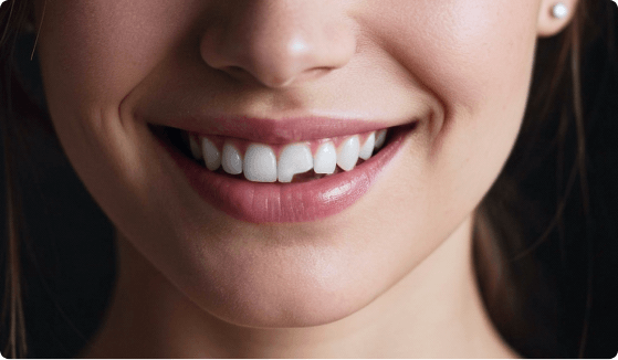 Treatment of dental injuries