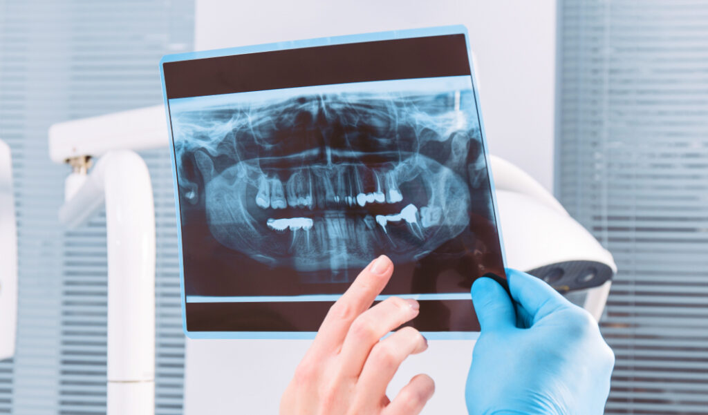Understanding Oral Surgery — What You Need to Know