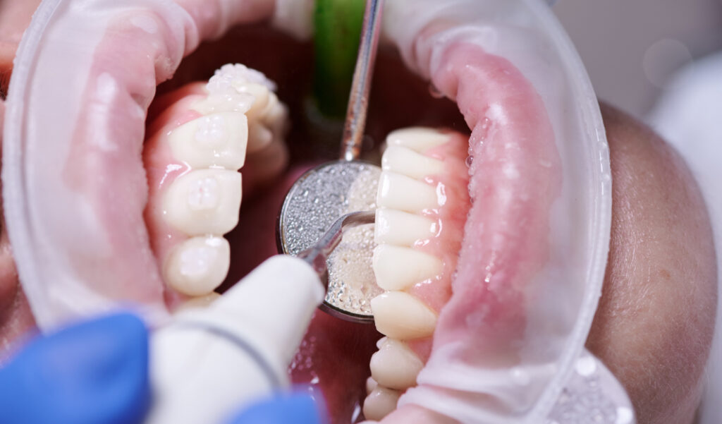 Professional hygiene in a dental office — The complete guide