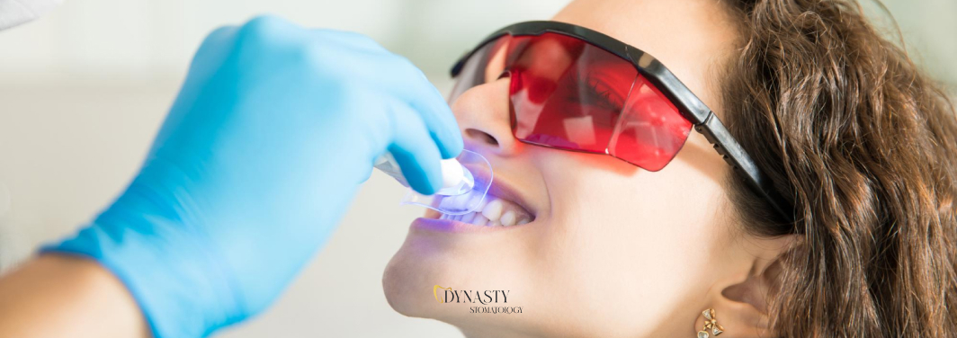 What You Need to Know About Professional Teeth Whitening