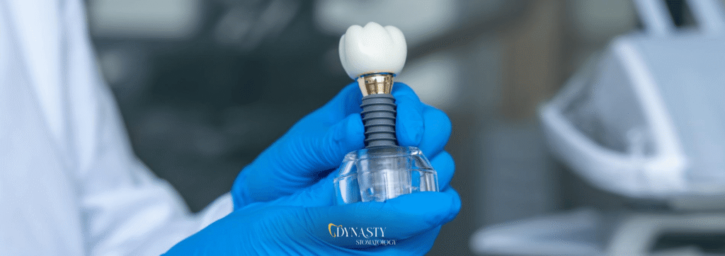 What is Teeth in a Day – Steps Of The Immediate Implantation Procedure