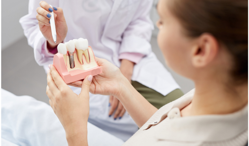 Dental Implants – What You Should Know