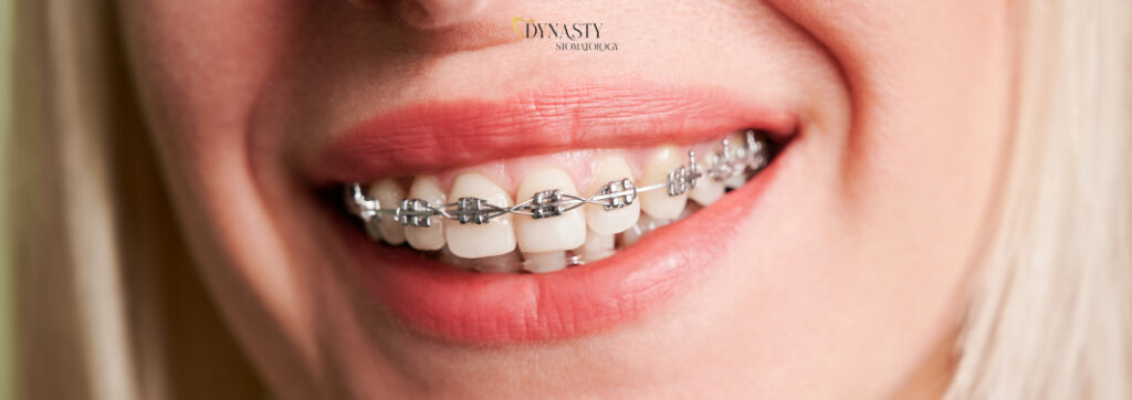 Orthodontics