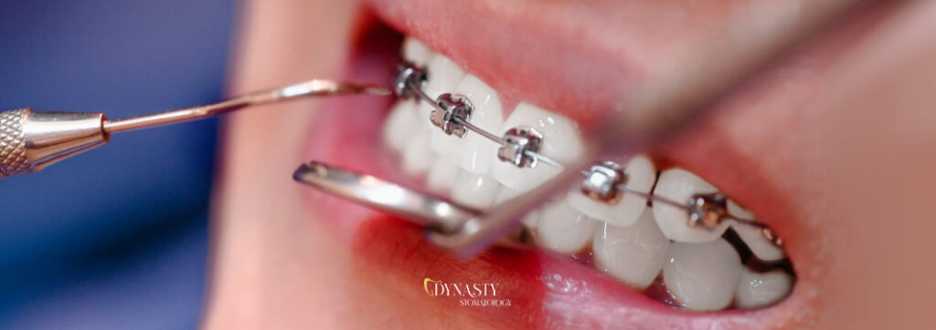 Orthodontics