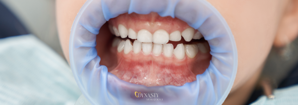 Pediatric dental services