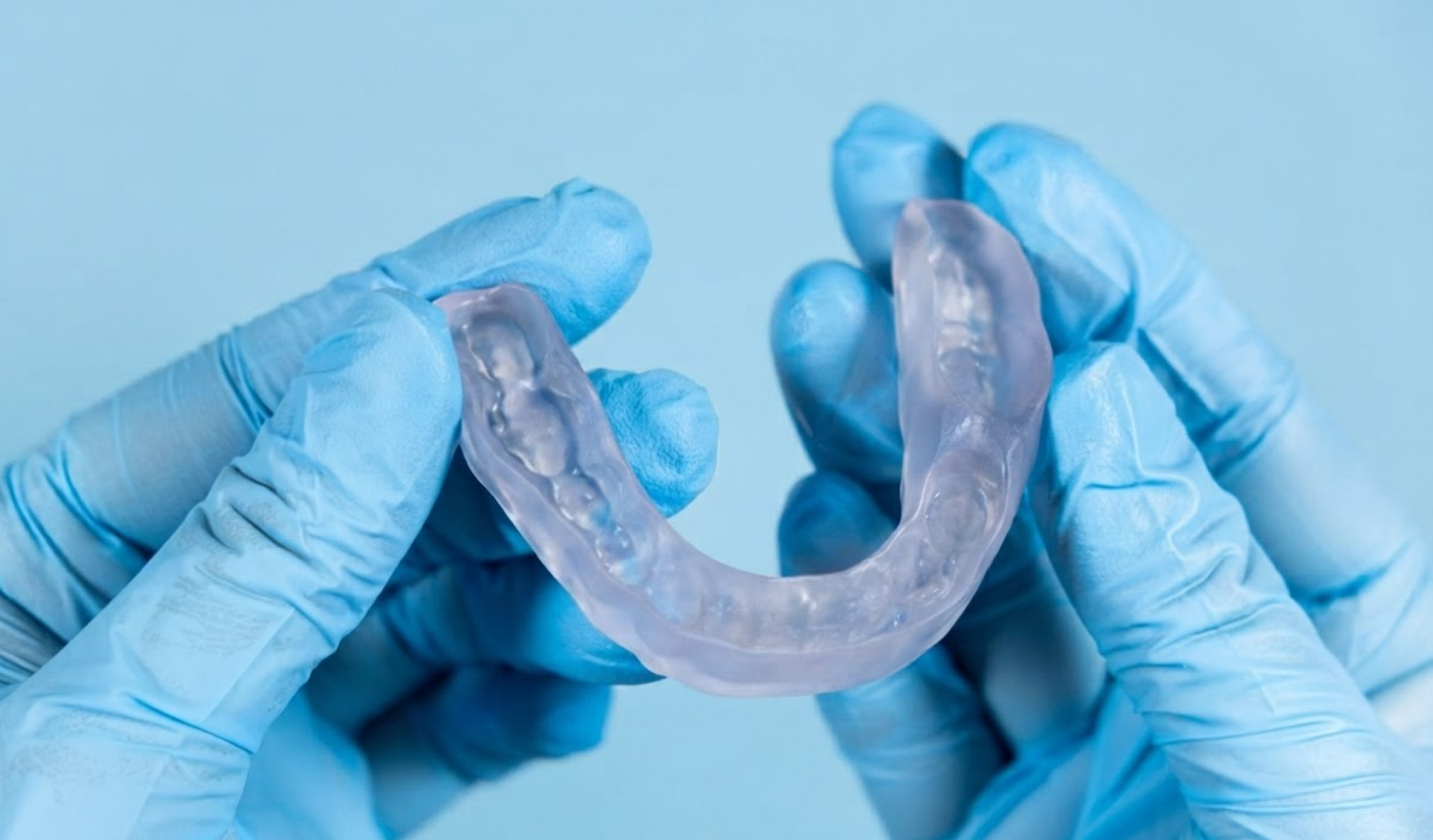 Teeth Grinding in Children – What Every Parent Should Know