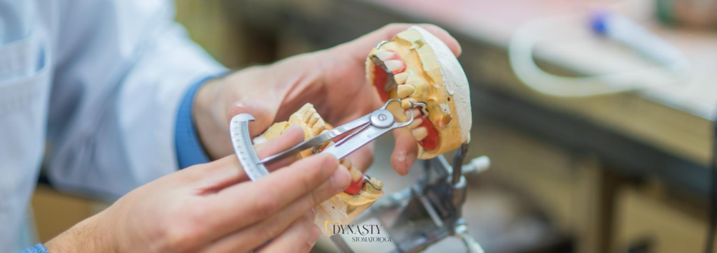 Partial Dentures – What Are They and When Are They Worth Choosing?