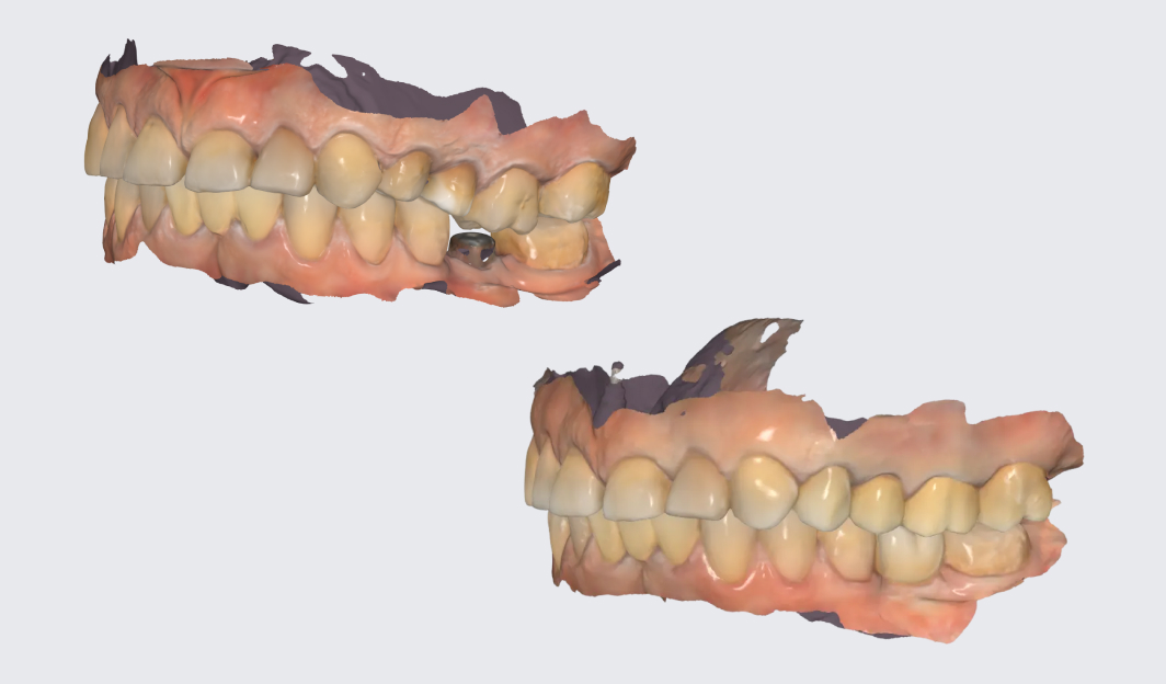 Przypadek: jak działa kompleksowe podejście w Dynasty Stomatology